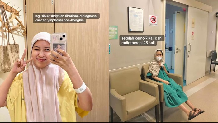 Viral Wanita Usia 22 di Kepri Kena Kanker Limfoma, Ini Gejala Awalnya