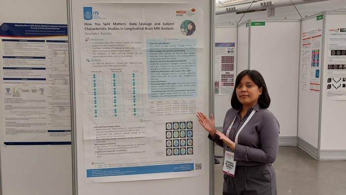 Doktor ITS bikin teknologi AI pembaca MRI