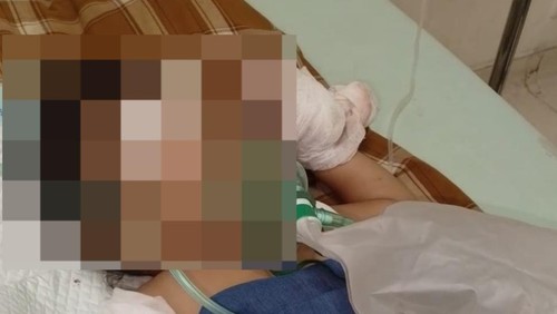 Aruni dirawat di RSUP NTB Mataram, Selasa, (22/4/2025) malam. (Dok. Pribadi Andika)