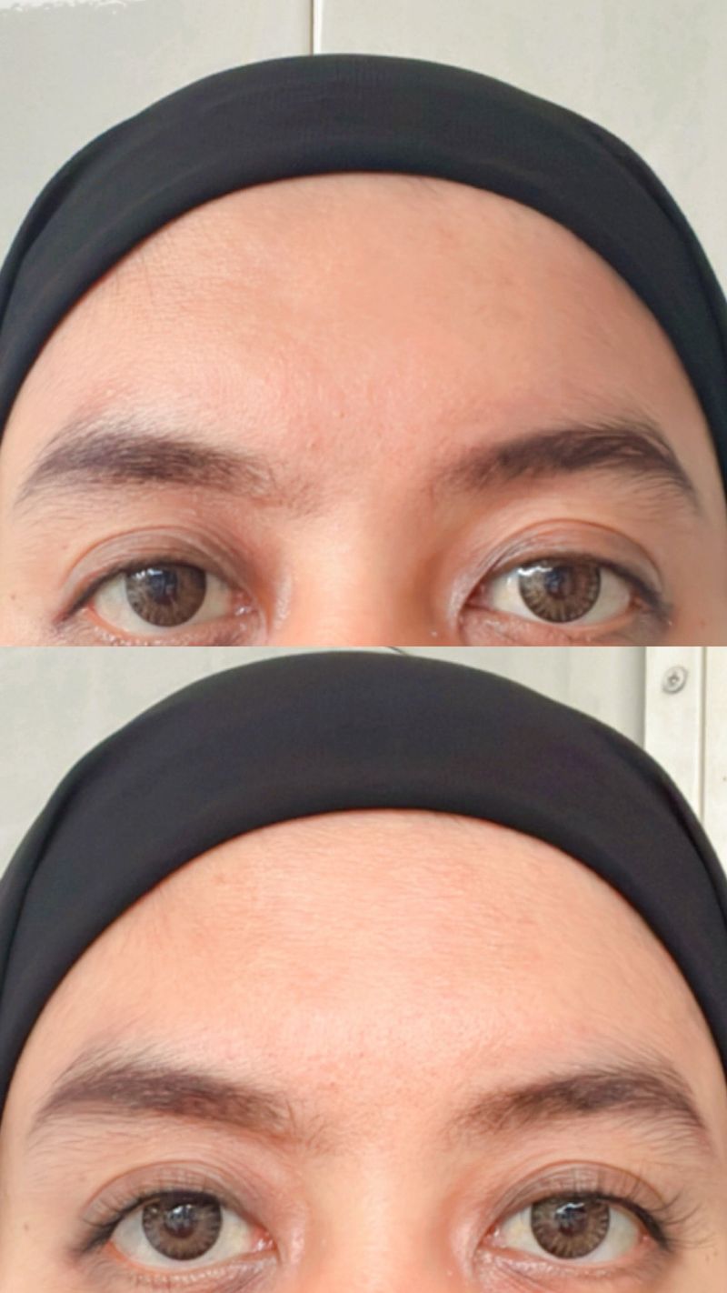 Sebelum (atas) dan sesudah (bawah) pemakaian Wosado Magnetic Lashes.