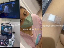 Wanita di Tangsel Kena Gangguan Liver di Usia 21, Awalnya Dikira Masuk Angin Biasa