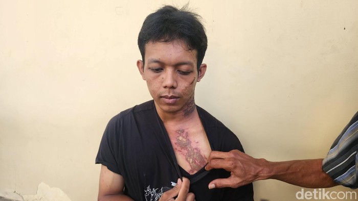 Bagus saat melapor ke polisi
