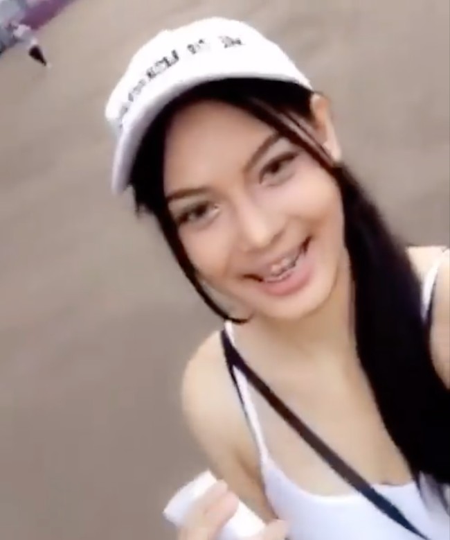 Mengenakan tanktop dan topi putih, Erika tampak berbeda dengan gigi yang masih menggunakan behel. Warna kulitnya pun di video tersebut terlihat lebih cerah. Banyak netizen yang menyebut penampilan Erika sebelum operasi plastik itu jauh berbeda dengan saat ini. Foto: Instagram/@eri.carl
