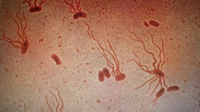 Salmonella Typhi.