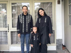 Kondisi Kaki Istri Fiersa Besari Imbas Ditabrak Mobil