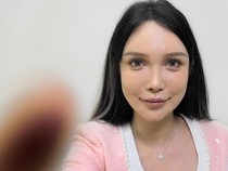 Kisah Perempuan China Sudah 100 Kali Operasi Plastik