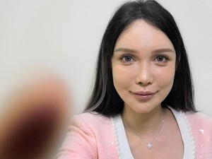 Kisah Perempuan China Sudah 100 Kali Operasi Plastik