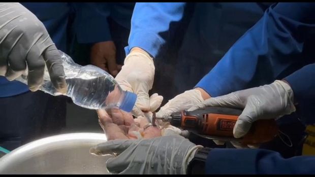 Aksi Damkar Trenggalek menolong dokter melepas cincin di jari pasien ODGJ.