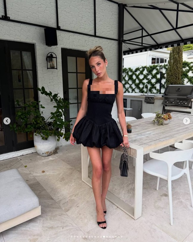 Kesuksesan Alix tidak hanya terbatas pada media sosial. Pada 2023, ia meluncurkan podcast berjudul ‘Hot Mess’, meski kemudian dihentikan oleh Unwell Network milik Alex Cooper di tengah isu perselisihan. Pada Juni 2024, ia tampil di video klip ‘Girls’ milik The Kid Laroi dan bahkan membintangi tiga iklan Super Bowl pada Februari 2025. Foto: Dok. Instagram Alix Earle