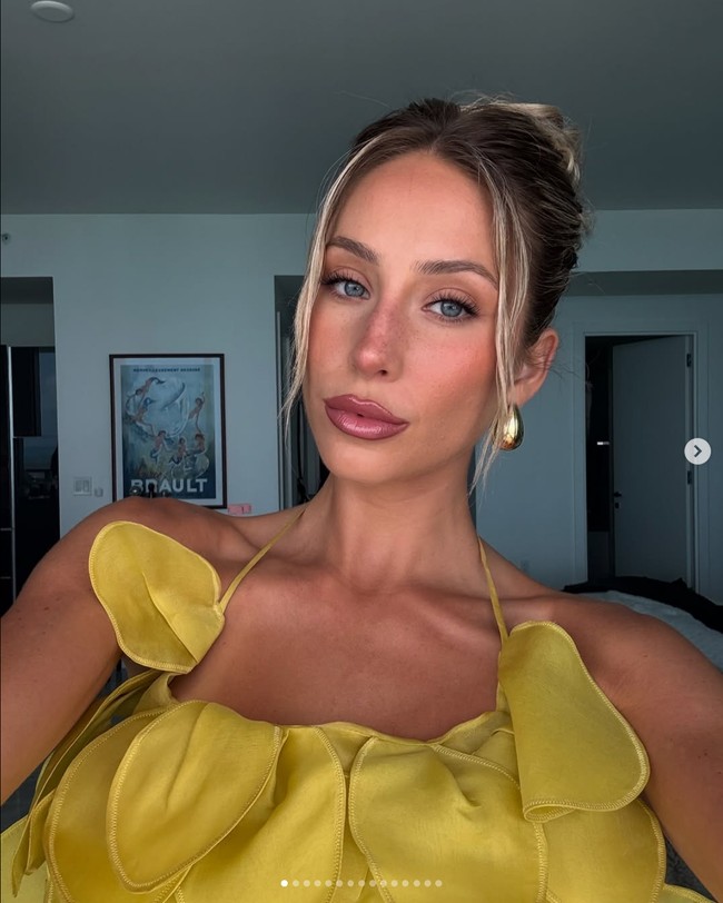 Dia semakin dikenal saat ia secara jujur membagikan perjuangannya melawan jerawat pada 2022. Foto: Dok. Instagram Alix Earle