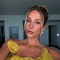 Dia semakin dikenal saat ia secara jujur membagikan perjuangannya melawan jerawat pada 2022. Foto: Dok. Instagram Alix Earle