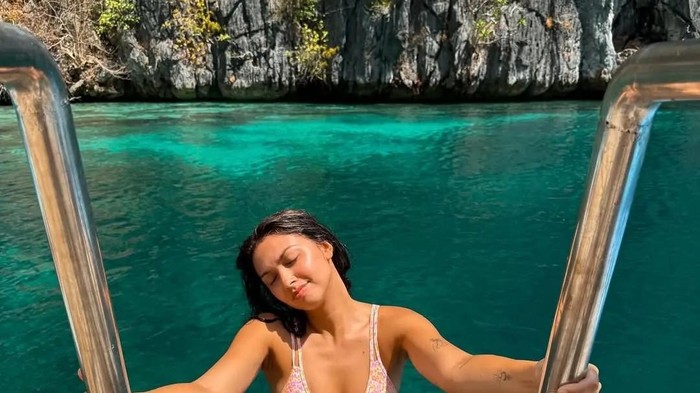 Influencer Cantik Disengat Ubur-ubur Mematikan