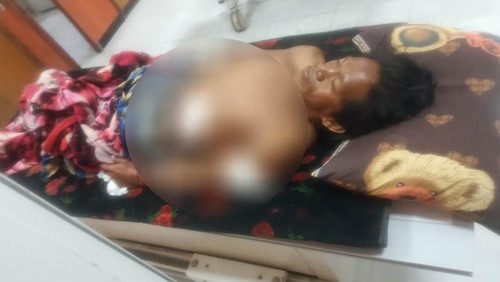 Pria bernama Ahmad dirawat seusai dianiaya menggunakan senjata tajam oleh sekelompok orang di Desa Nanga Tumpu, Kecamatan Manggelewa, Dompu, NTB. (Foto: Dok. Istimewa)