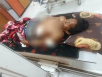 Pria di Dompu Nyaris Tewas Seusai Dibacok Sekelompok Orang