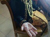 Cincin Manten Pria Bikin Jari Bengkak, Damkar Sukoharjo Turun Tangan