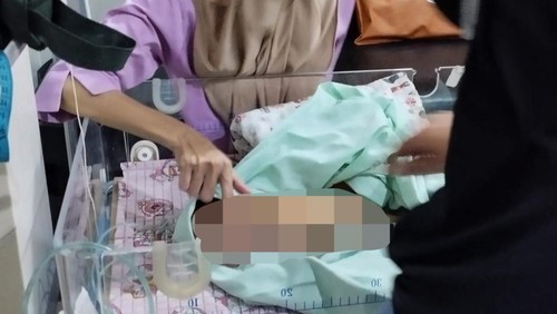 Tenaga medis  melakukan perawatan bayi yang ditemukan di toilet PKM Selong, Lombok Timur, NTB. Jumat (2/05/2025). (Sanusi Ardi W/detikBali)