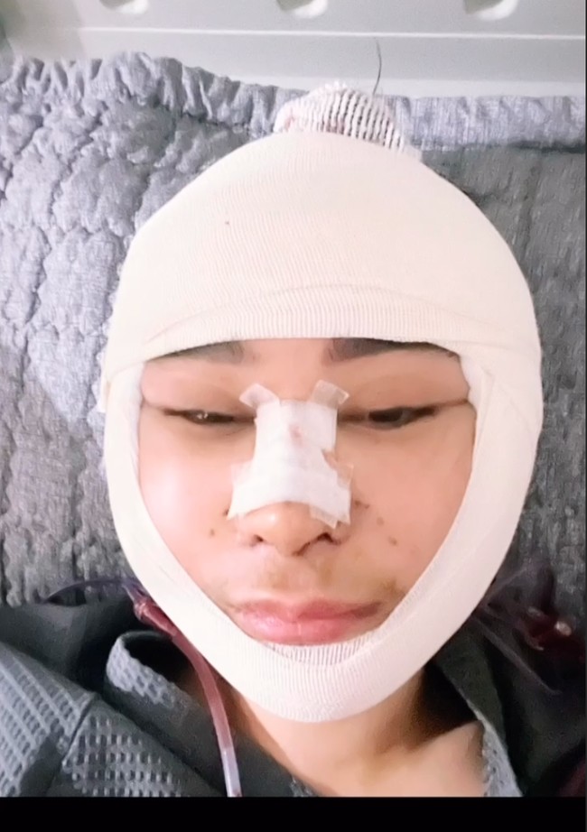 Dari keterangan unggahannya diketahui bahwa Uut menjalani operasi plastik berupa liposuction, rhinoplasty, dan face lifting. Begini penampilan Uut setelah oplas. Foto: Instagram/@uutpermatasari