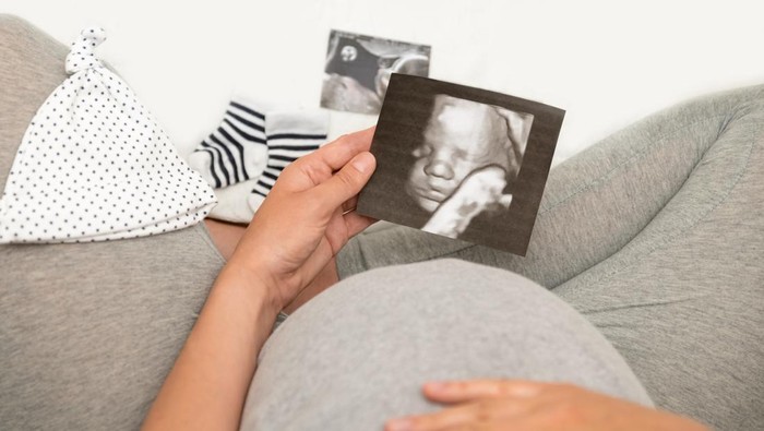 Pregnant woman holding 4D ultrasound image