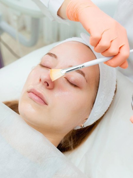 Review Lhala Peel, Treatment Viral untuk Kulit Glowing Tanpa Downtime