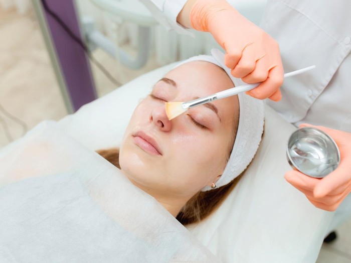 Ilustrasi chemical peeling.