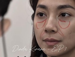 8 Foto Dinda Kirana Oplas Wajah Hingga Payudara di Korea, Jadi Makin Cantik
