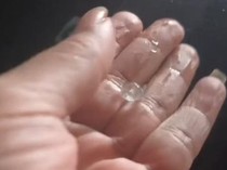 Hujan Es dan Angin Kencang Terjang Prambanan Klaten