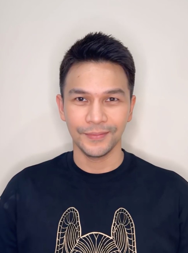 Setelah tindakan wajah Ijonk jadi terlihat lebih tirus dengan kulit yang makin kencang. Penampilannya pun jadi semakin fresh. Foto: Instagram/@ij.flawless