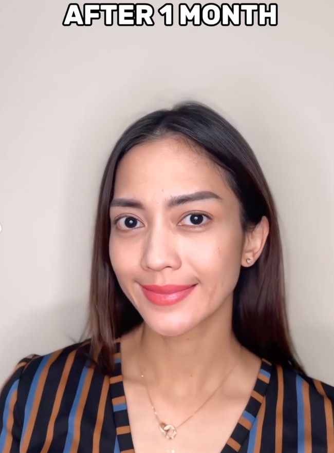 Begini penampilan Ririn 1 bulan setelah menjalani prosedur kecantikan. Wajahnya tampak tak jauh berbeda, hanya terlihat jadi lebih kencang dan flawless. Foto: Instagram/@ij.flawless