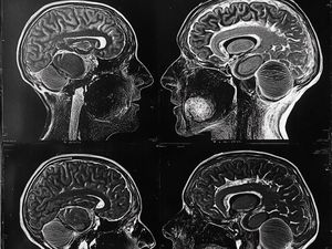 Cognitive Debt: Utang Kognitif, Akibat Otak yang Jarang Dipakai