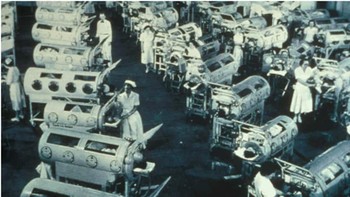 Poliomielitis, yang sering disebut polio, adalah penyakit virus yang sudah ada sejak jaman dahulu kala, tetapi wabah yang terjadi pada abad ke-19 dan awal abad ke-20 memperburuk ketakutan terhadap penyakit tersebut. Dokter Amerika Jonas Salk mengembangkan vaksin untuk polio pada tahun 1953, meskipun vaksin tersebut belum tersedia untuk penggunaan luas di AS hingga tahun 1955. Lebih dari 100.000 kasus polio dilaporkan di AS antara tahun 1950 dan 1953, dengan 6.600 nyawa melayang. Foto: Ranker