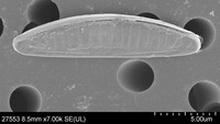 Species baru mikroalga Catenula boyanensis. Nama ini diambil untuk menghormati penduduk asli Pulau Bawean yang disebut Boyan. Foto: Universitas Brawijaya