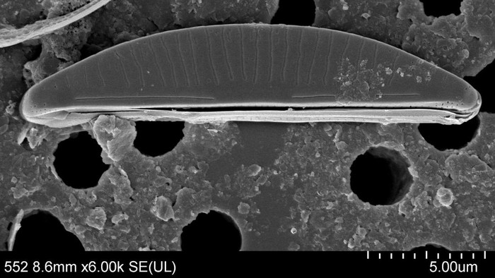 Species baru mikroalga Paracatenula porostriata.