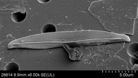 Species baru mikroalga bernama Catenula komodonensis dengan bentuk seperti badan komodo. Lima spesies baru dari kelompok Catenula yaitu Catenulopsis baweana, Catenula komodensis, Catenula densestriata, Catenula decusa, dan Catenula boyanensis. Foto: Universitas Brawijaya