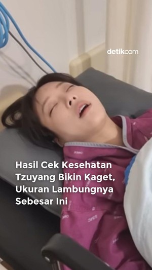 Video: Bisa Makan Banyak, Ukuran Lambung Tzuyang Sebesar Ini