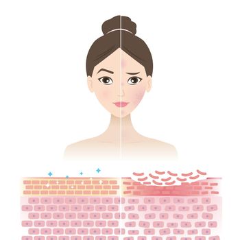 Skincare dan Skin Barrier