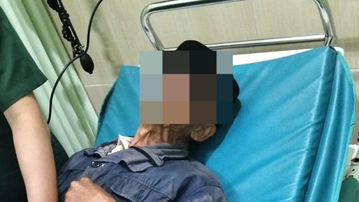 Kakek di Ngawi yang minta bantuan melepas paralon di kelaminnya.