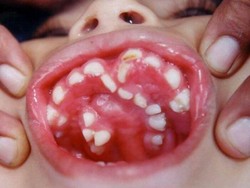 Bukan Editan Photoshop, Deretan Foto Medis Bikin Melotot dan Merinding