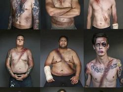 Bukan Editan Photoshop, Deretan Foto Medis Bikin Melotot dan Merinding
