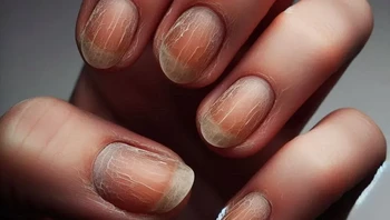 Seiring bertambahnya usia, kuku tumbuh lebih lambat dan menjadi kusam, rapuh, dan berubah warna, mulai dari bening hingga kuning dan keruh. Kuku kaki dapat menebal dan mengeras, sehingga meningkatkan kemungkinan kuku tumbuh ke dalam, dan ujung kuku tangan dapat terbelah. Foto: via Bright Side