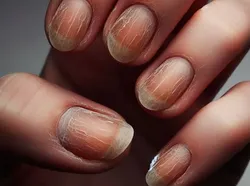 10 Tanda Kamu Mulai Menua, Semuanya Wajar