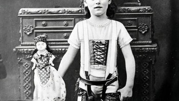 Gadis Muda Mengenakan Kaki Palsu, Inggris, 1890-1910 Foto: Boredpanda