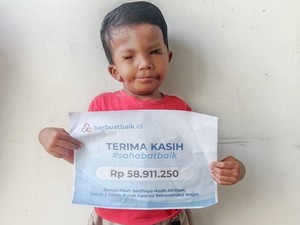 Dibantu Sahabat Baik, Kondisi Afriliam Membaik Usai Operasi Langit-langit Mulut