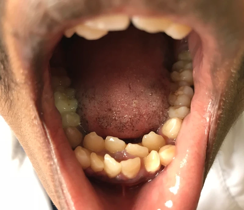 Beberapa orang terlahir dengan kelebihan yang tak dimiliki yang lain, misalnya polydactyly yang memiliki ekstra jari tangan atau kaki. Ini dia di antaranya.