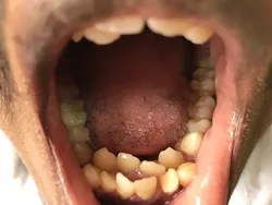 10 Orang dengan Tubuh yang Luar Biasa Unik