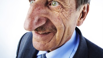 Mehmet Özyürek mempunyai hidung yang panjangnya mencapai 3,48 inch atay 8,8 cn. Dia tak pernah terpikir untuk mengubah bentuk fisiknya itu. Salut! Foto: Instagram/meh.metozyurek