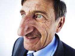 10 Orang dengan Tubuh yang Luar Biasa Unik