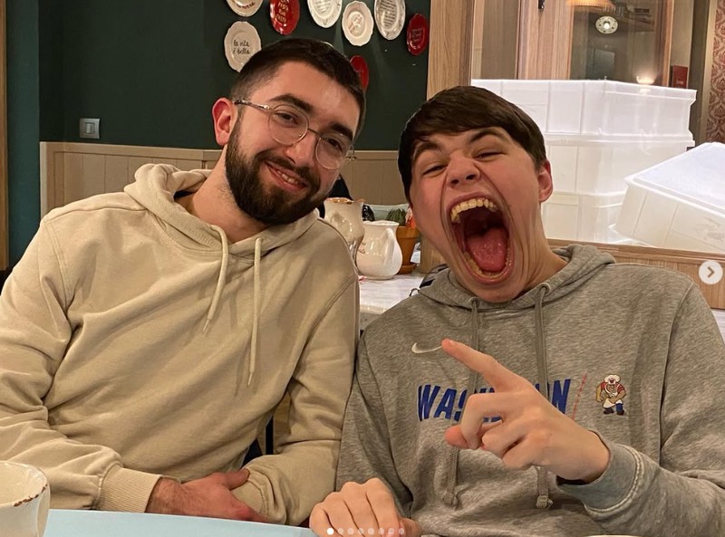 Beberapa orang terlahir dengan kelebihan yang tak dimiliki yang lain, misalnya polydactyly yang memiliki ekstra jari tangan atau kaki. Ini dia di antaranya.