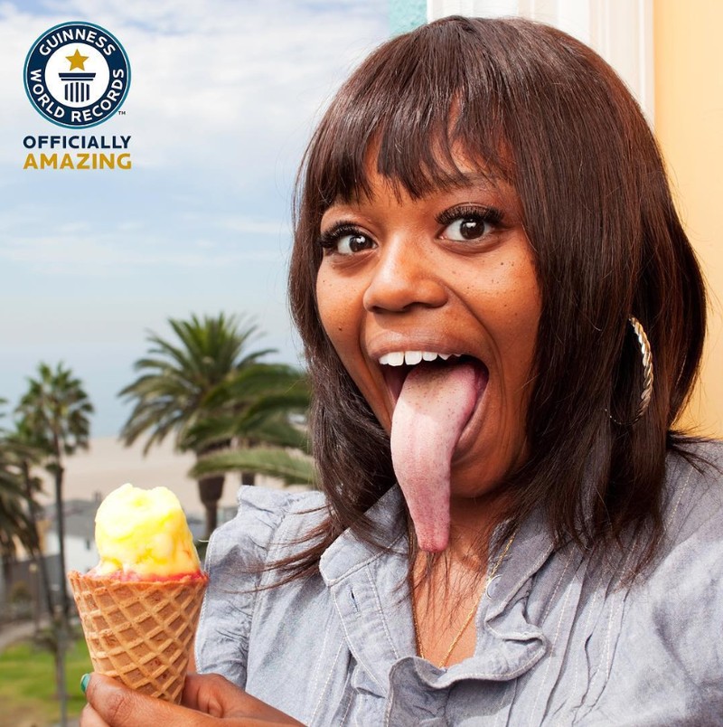 Beberapa orang terlahir dengan kelebihan yang tak dimiliki yang lain, misalnya polydactyly yang memiliki ekstra jari tangan atau kaki. Ini dia di antaranya.