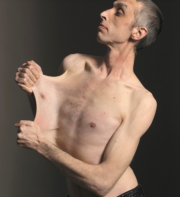10 Orang dengan Fitur Tubuh yang Luar Biasa Unik Beberapa orang terlahir dengan kelebihan yang tak dimiliki yang lain, misalnya polydactyly yang memiliki ekstra jari tangan atau kaki. Ini dia di antaranya.