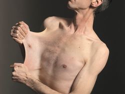 10 Orang dengan Tubuh yang Luar Biasa Unik